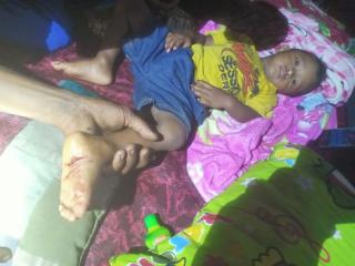 Bocah 2 Tahun Diserang Harimau Saat Tidur di Camp Perkebunan Sawit di Siak